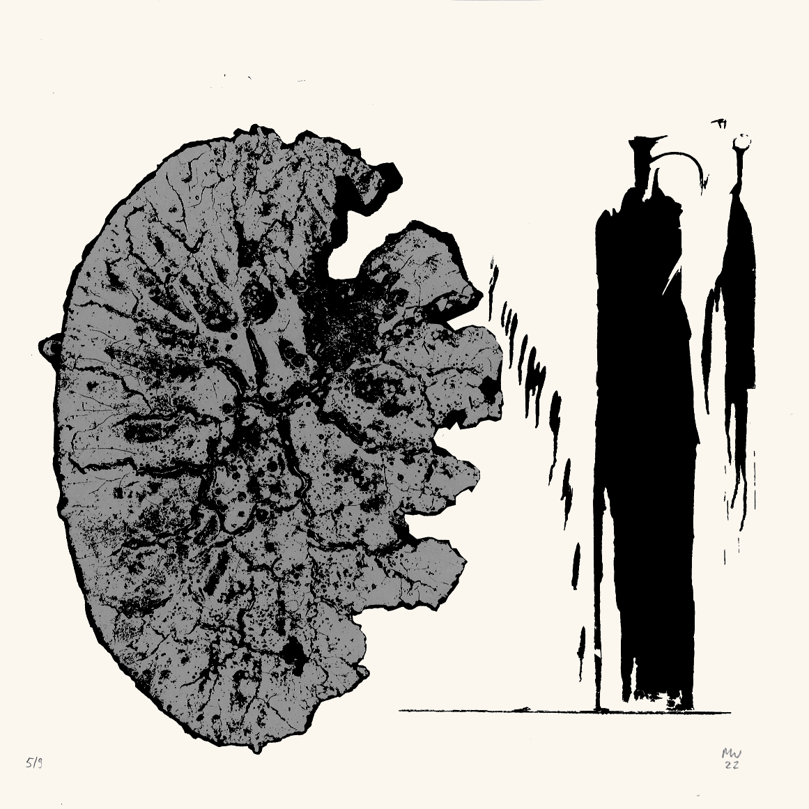 Komplex – MIchael Wismar